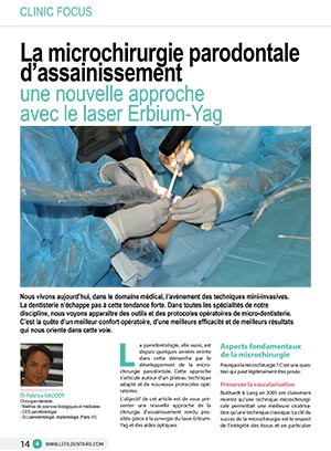 la-microchirurgie-parodontale-dassainissement-1