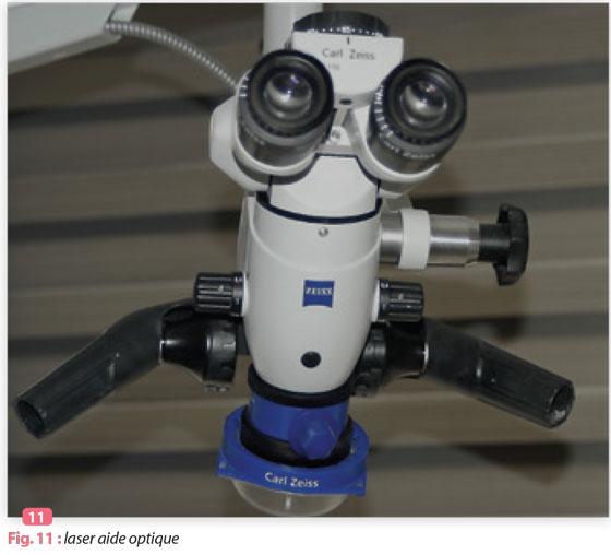 laser-aide-optique-zeiss