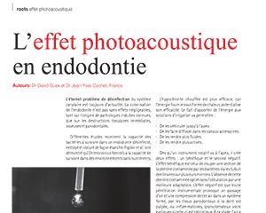 L’effet photoacoustique en endodontie