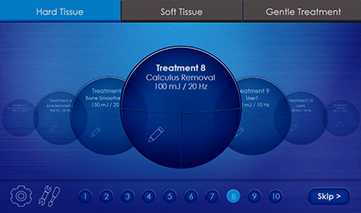 LiteTouch-Predefined-Presets-–-Adjustable-Parameters