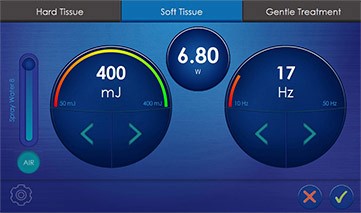 Manual-Parameter-Settings